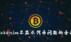 解决Tokenim不显示代币问题的全面指南